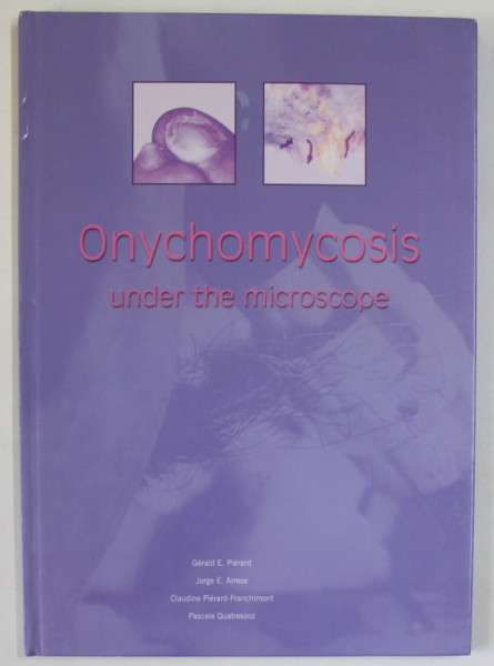 ONYCHOMYCHOSIS UNDER THE MICROSCOPE by GERALD E. PIERARD ...PASCALE QUATRESOOZ , ANII '2000