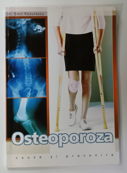 OSTEOPOROZA , CAUZE SI PREVENIRE de Dr. EMIL RADULESCU , 2004