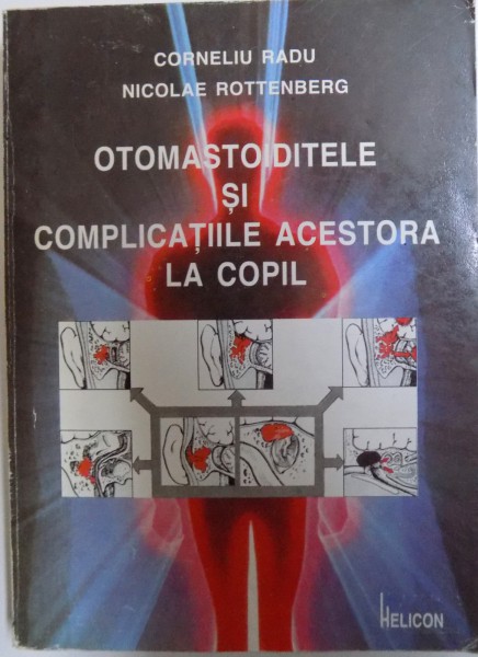 OTOMASTOIDITELE SI COMPLICATIILE ACESTORA LA COPIL de CORNELIU RADU si NICOLAE ROTTENBERG , 1997