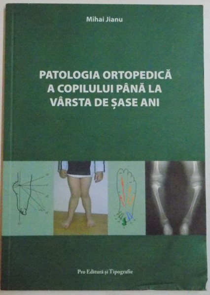 PATOLOGIA ORTOPEDICA A COPILULUI PANA LA VARSTA DE SASE ANI de MIHAI JIANU , 2011