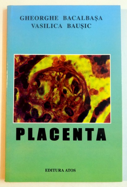 PLACENTA de GHEORGHE BACALBASA , VASILICA BAUSIC , 2000