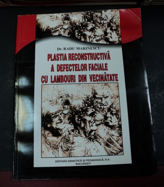 PLASTIA RECONSTRUCTIVA A DEFECTELOR FACIALE CU LAMBOURI DIN VECINATATE BUCURESTI 2002-DR.RADU MARINESCU