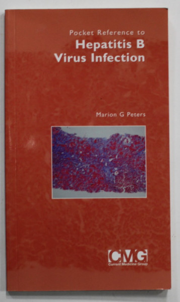 POCKET REFERENCE TO HEPATITIS B VIRUS INFECTION by MARION G. PETERS , 2006