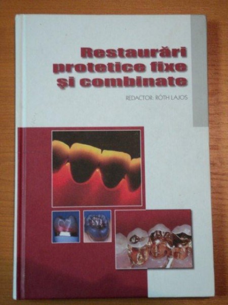 RESTAURARI PROTETICE FIXE SI COMBINATE-  BRITTA MEISTER, CLAUS PUKROPP...
