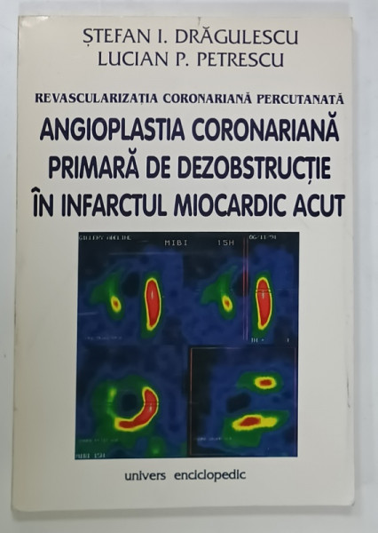 REVASCULARIZATIA  CORONARIANA  PERCUTATNATA  : ANGIOPLASTIA CORONARIANA PRIMARA DE DEZOBSTRUCTIE IN INFARCTUL MIOCARDIC  ACUT de STEFAN I. DRAGULESCU si LUCIAN P. PETRESCU , 1996