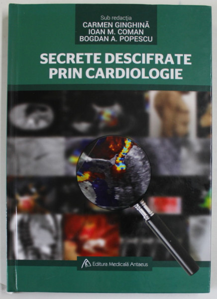 SECRETE DESCIFRATE PRIN CARDIOLOGIE , sub redactia CARMEN GINGHINA ...BOGDAN A. POPESCU , 2019, CD INCLUS *