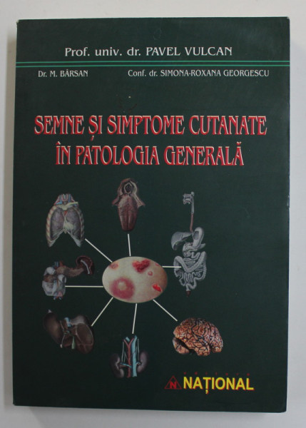 SEMNE SI SIMPTOME CUTANATE IN PATOLOGIA GENERALA de PAVEL VULCAN ..SIMONA - ROXANA GEORGESCU , 2004 ,