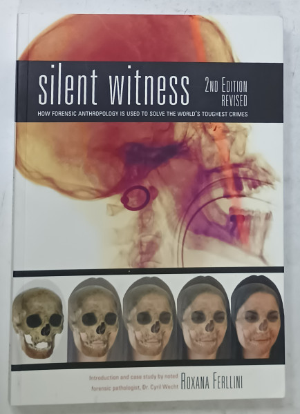 SILENT WITNESS , HOW FORENSIC ANTHROPOLOGY IS USED TO SOLVE THE WORLD ' S TOUGHEST CRIMES by ROXANA  FERLLINI , 2012