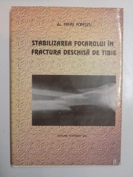 STABILIZAREA FOCARULUI IN FRACTURA DESCHISA DE TIBIE de MIHAI POPESCU , 1997