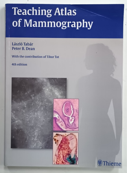 TEACHING ATLAS OF MAMMOGRAPHY by LASZLO TABAR and PETER B. DEAN , 669 ILLUSTRATION , 2012, EXEMPLAR XEROXAT