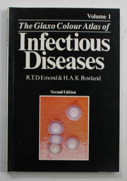 THE GLAXO COLOUR ATLAS OF INFECTIOUS DISEASES by R.T.D. EMOND and H.A.K. ROWLAND , VOLUME ONE , 1990
