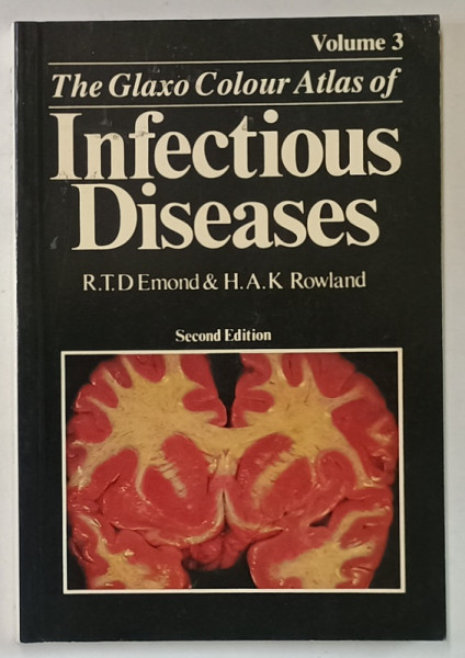 THE GLAXO COLOUR ATLAS OF INFECTIOUS DISEASES , VOLUME 3 by R.T.D. EMOND and H.A.K. ROWLAND , 1987