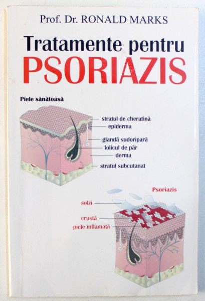 TRATAMENTE PENTRU PSORIAZIS de Prof. Dr. RONALD MARKS , 2005