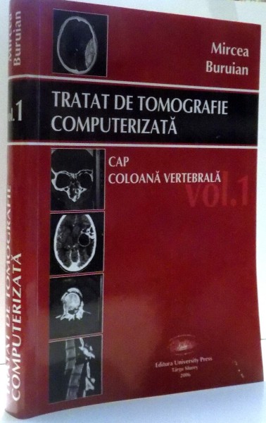 TRATAT DE TOMOGRAFIE COMPUTERIZATA, CAP, COLOANA VERTEBRALA de MIRCEA BURUIAN, VOL I , 2006