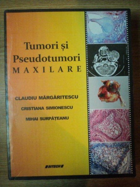 TUMORI SI PSEUDOTUMORI MAXLARE de CLAUDIU MARGARITESCU , CRISTINA SIMIONESCU , MIHAI SURPATEANU , 2010