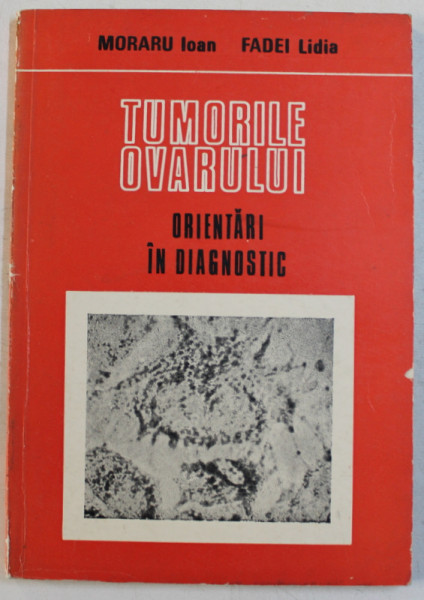 TUMORIL OVARULUI - ORIENTERI IN DIAGNOSTIC de MORARU IOAN si FADEI LIDIA , 1988