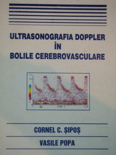 ULTRASONOGRAFIA DOPLER IN BOLILE CEREBROVASCULARE de CORNEL C. SIPOS SI VASILE POPA