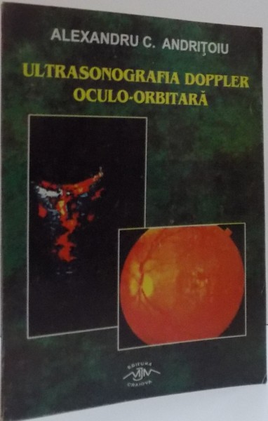 ULTRASONOGRAFIA DOPPLER OCULO-ORBITARA , 2003