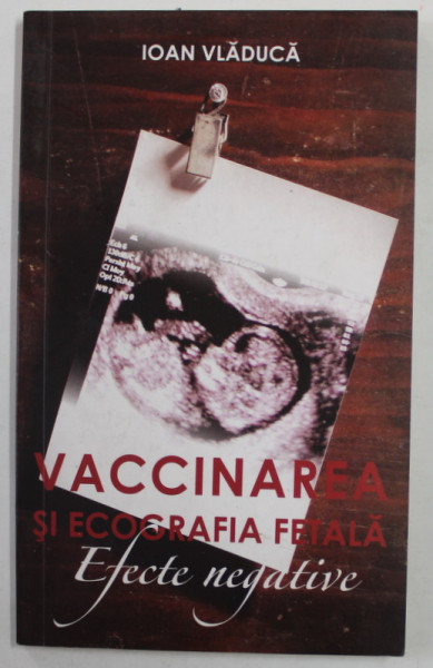 VACCINAREA SI ECOGRAFIA FETALA - EFECTELE NEGATIVE de IOAN VLADUCA , 2011