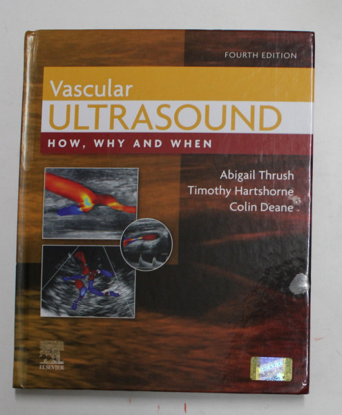 VASCULAR ULTRASOUND - HOW , WHY AND WHEN by ABIGAIL THRUSH ...COLIN DEANE , 2010