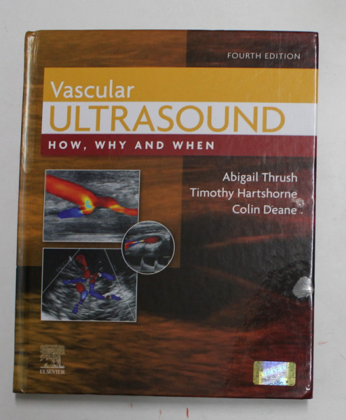 VASCULAR ULTRASOUND - HOW , WHY AND WHEN by ABIGAIL THRUSH ...COLIN DEANE , 2010